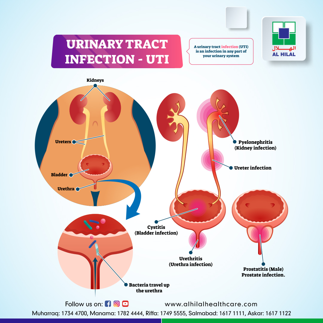 case study for urinary tract infection