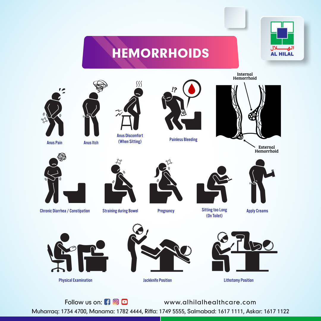 Hemorrhoids