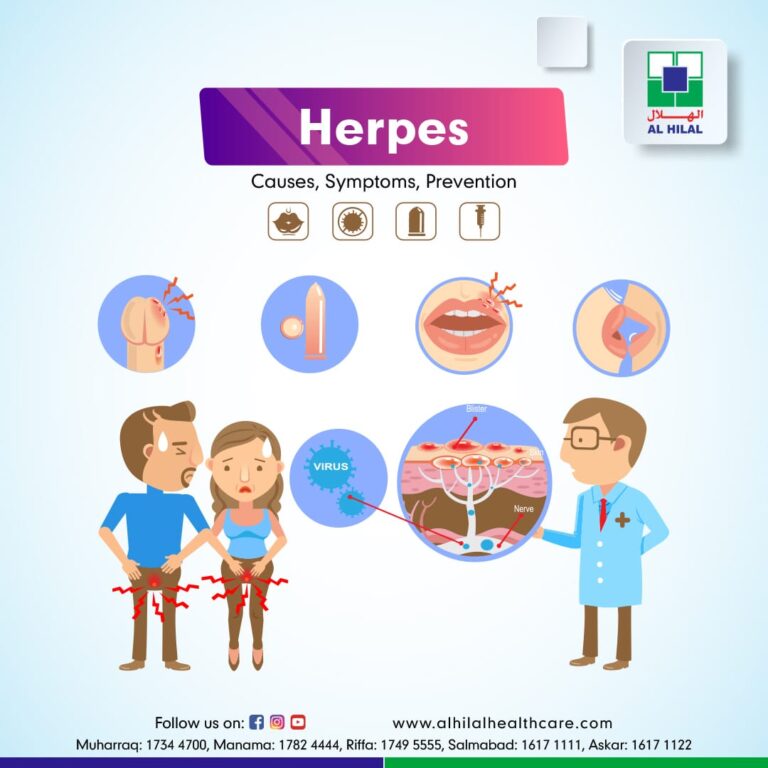 Herpes