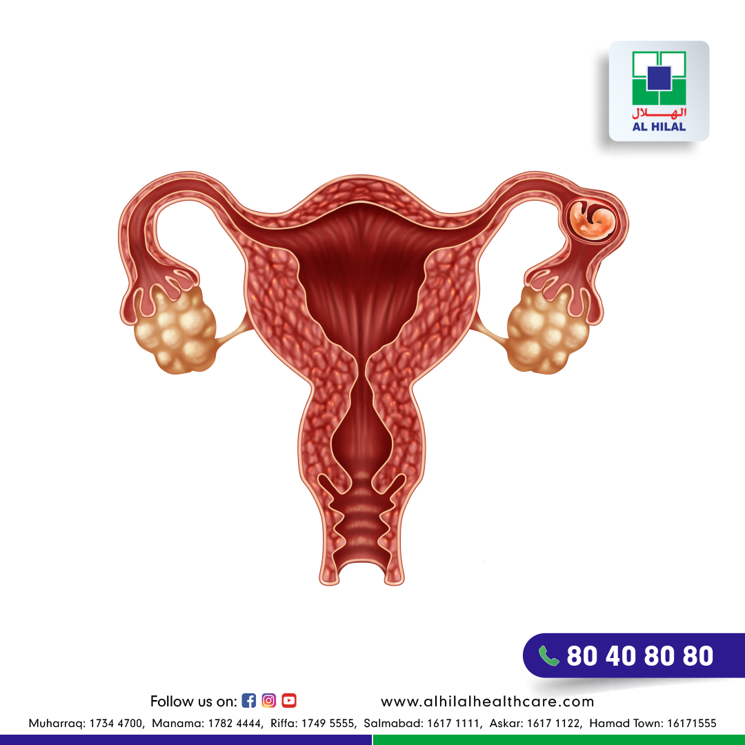 all-you-need-to-know-about-ectopic-pregnancy